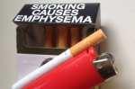 stop smoking hypnosis sessions, why not quit today?